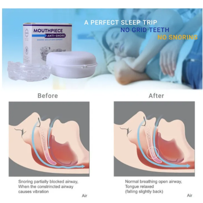 Dispositivo Para Dormir Antironquido